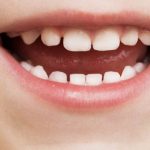 چرا دندان های شیری بسیار اهمیت دارند؟