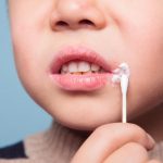 بررسی انواع ضایعات دهانی در کودکان و روش درمان آنها