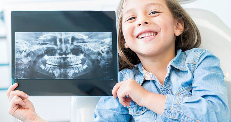 رادیوگرافی در دندانپزشکی کودکان