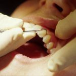 مراقبت های بعد از دندان پزشکی در کودکان