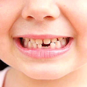 دندان در آوردن کودکان