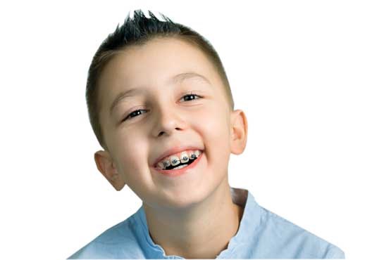 ارتودنسی دندان در کودکان
