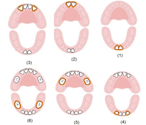 ترتیب رشد دندان شیری
