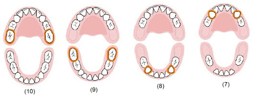 ترتیب رشد دندان شیری