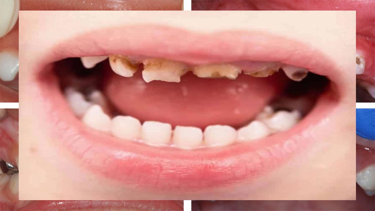 آناتومی یا ساختمان دندان