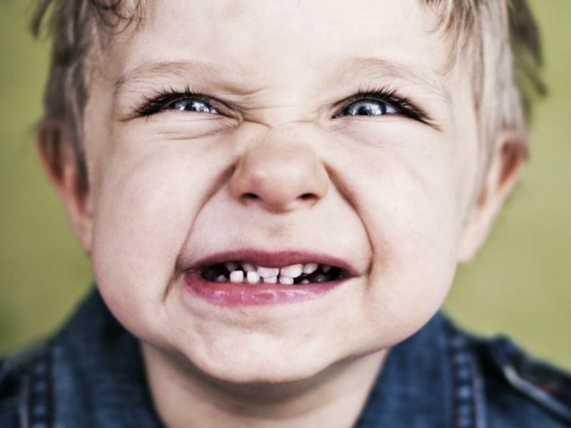 علل حساسیت دندان در کودکان،