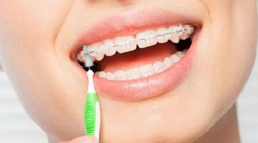 Dental orthodontics 7