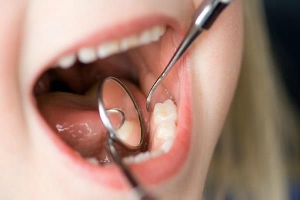 جلوگیری از پوسیدگی دندان کودکان.
