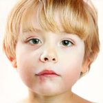 بیماری تبخال اولیه در کودکان چیست ؟