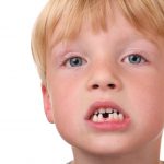 دلایل نامرتبی دندان های کودکان