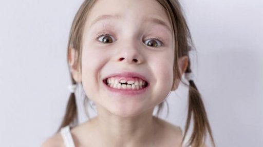 Children's permanent teeth 3