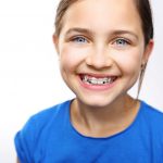 فضانگهدار دندان ها چیست و چه کاربردی دارد ؟