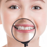 علت رویش کج دندان کودکان