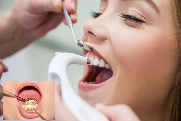 Children's dental mass 1