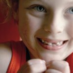 کج در آمدن دندان دائمی در کودکان چه عوارضی دارد ؟