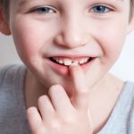 علت لق شدن دندان کودکان چیست ؟