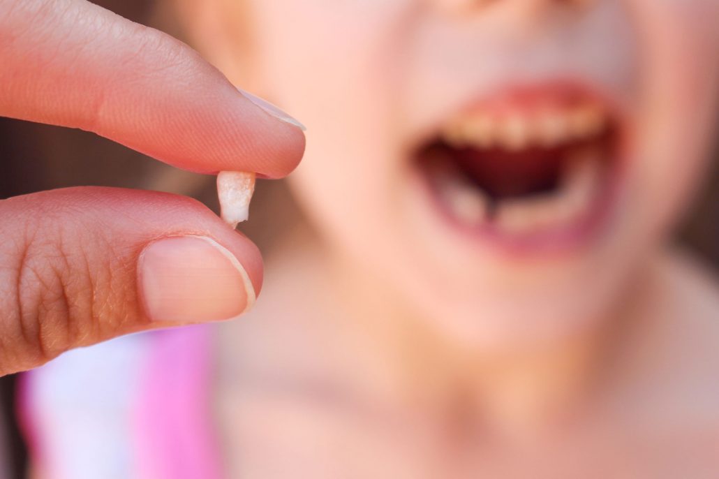 What causes loose teeth in children 3