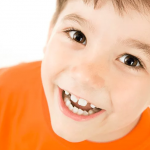 دیاستما یا فاصله بین دندانی چیست ؟