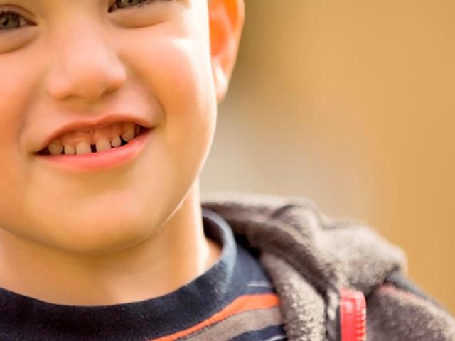 The distance between the teeth in children 3