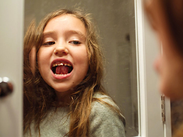 Eruption of permanent teeth in children 4