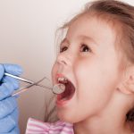 پیشگیری از پوسیدگی دندان شیری کودکان