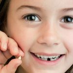 علت شکستگی دندان های شیری در کودکان
