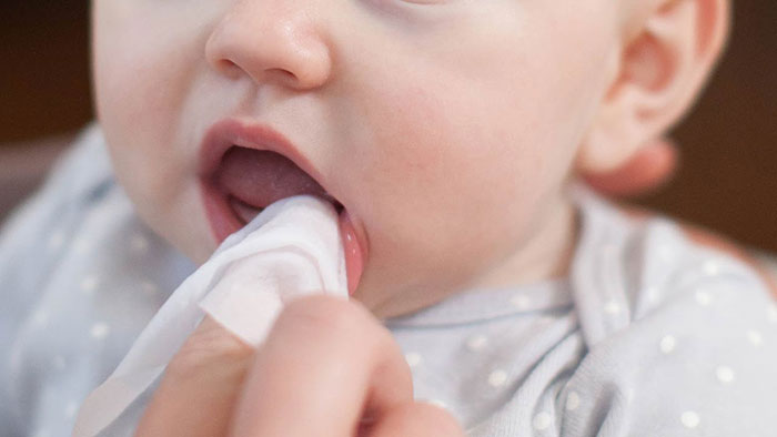 Gum swelling in children 2
