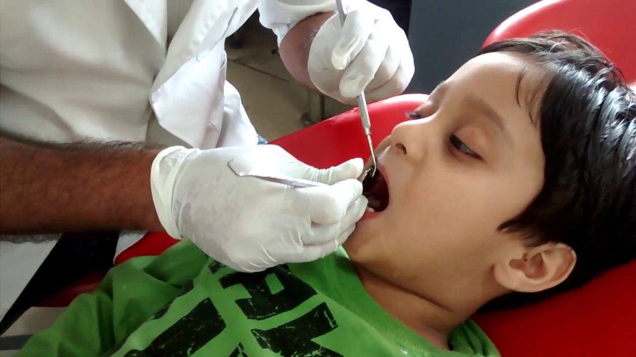Root canal treatment in children 1
