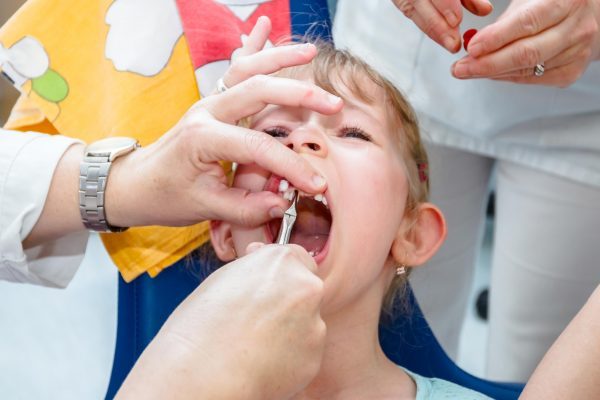 Children's tooth extraction 1