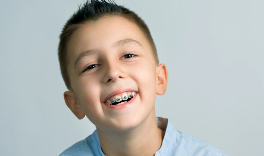 The distance between children's milk teeth 2