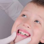 راه های جلوگیری از کج شدن دندان کودکان